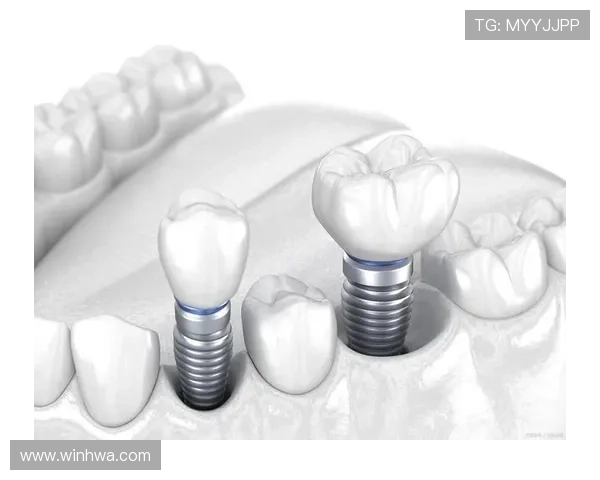 详细解析AG电投网会员注册方式，确保每一步都顺利完成账号绑定